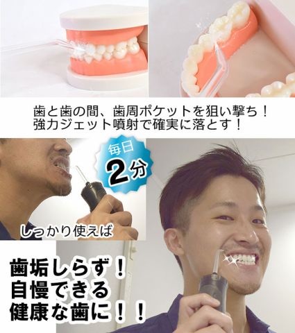 食べかすや歯垢をフロスを使わず簡単に取れるジェットウォッシャブル