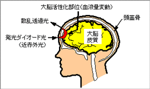 脳血液測定の原理