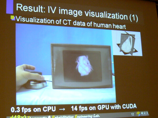 CUDAによる体内臓器の立体映像化システム