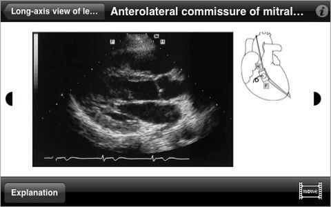 Diagnostic Ultrasound Video Clips