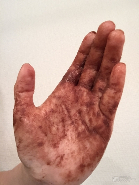 チョコレートトリートメント