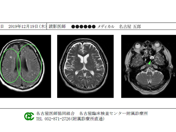 名古屋臨床検査センター、CTやMRIの結果をスマホで受け取り可能に
