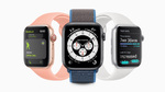 アップル「Apple Watch」血糖値測定機能のうわさ再び
