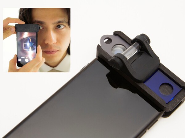 眼科医の診断ロジックをiPhoneで再現 スマホアタッチメント診療デバイス「Smart Eye Camera」 