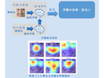 日本電気と筑波大学、浮腫（むくみ）の度合いをAI活用で顔映像から推定する技術を開発
