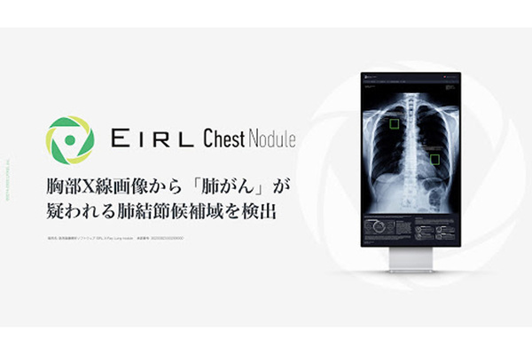 LPIXEL、医用画像解析ソフトウェア「EIRL Chest Nodule」にて検出感度を向上させた新モデルをリリース