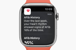 日本でもApple Watch「心房細動履歴」利用可能に