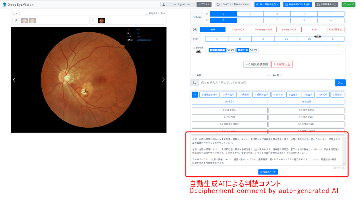 「アイフレイル」ってなに？目の不調に潜む病気発見にもAIが役立つ : - ASCII STARTUP