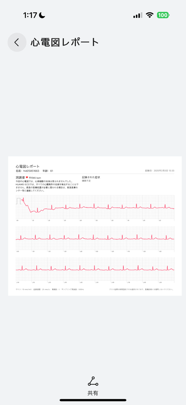 HUAWEI WATCH D2