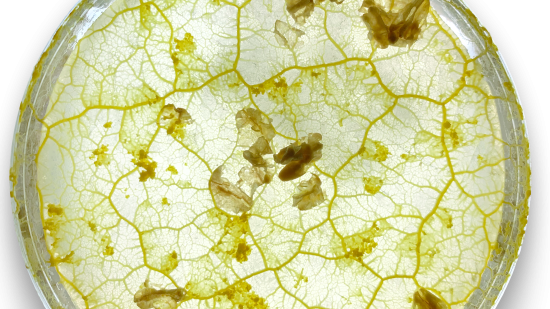 粘菌の「超能力」で都市インフラを設計/ニューラリンク元社長、「人工視覚」実用化