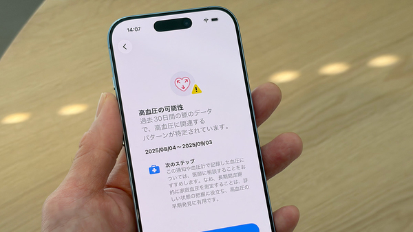 ついに日本でも解禁！ Apple Watchの「高血圧パターンの通知」を解説