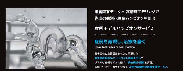 診断データから治療部位を再現した血管モデルを提供、「症例モデルサービス」提供開始