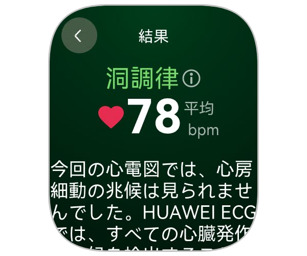 ファーウェイ