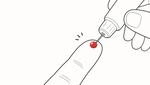 血液1滴で、すい臓がんのサインを読む。東大発コウソミルの1分子計測技術 血液1滴で、すい臓がんのサインを読む。東大発コウソミルの1分子計測技術