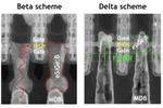 CFETの足を引っ張るPMOSを救え！ imecが提案する新絶縁層と、あえて精度を緩める「Notch Alignment」の妙手